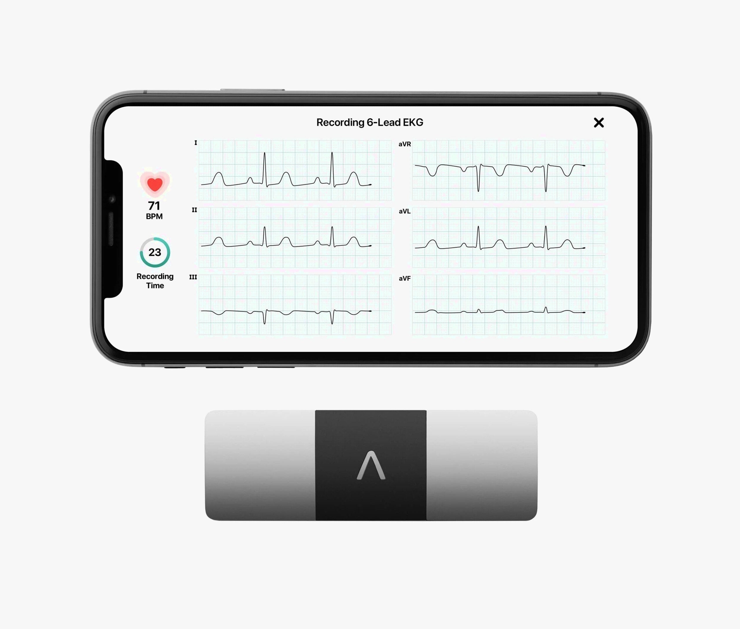 AliveCor KardiaMobile 6L Personal EKG Monitor, Black – KM-6L-E